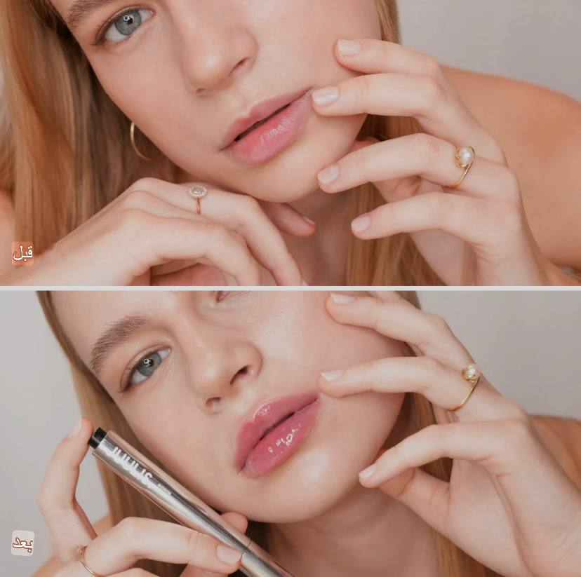 شفاه أكثر امتلاءً في لحظات بطريقة طبيعية